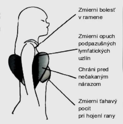 Ucinky